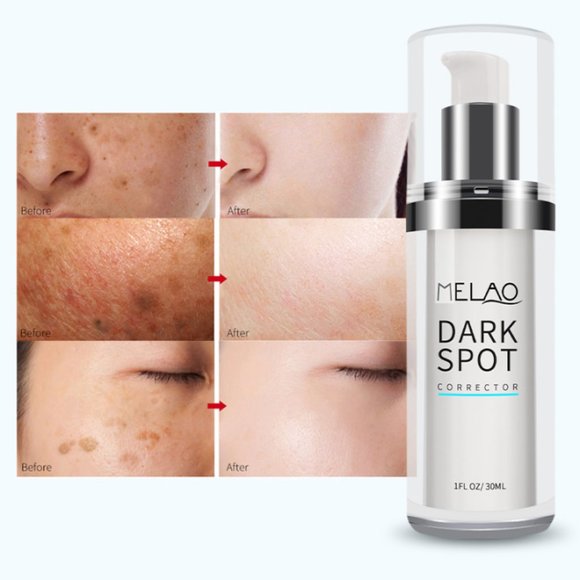 Dark Spot Corrector Serum Removal - Picture 4 of 9